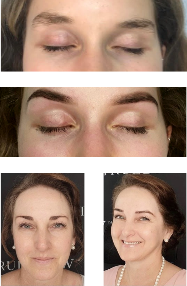 58 Simple Natural brow restoration and design system with modern Design